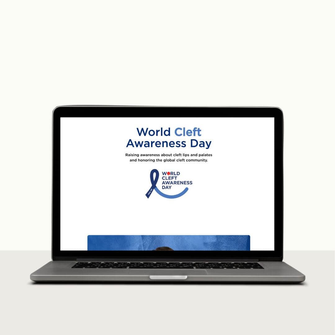 Cleft Day